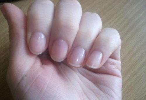 Полезен ли кальций для ногтей. Как правильно применять кальций для укрепления ногтей?