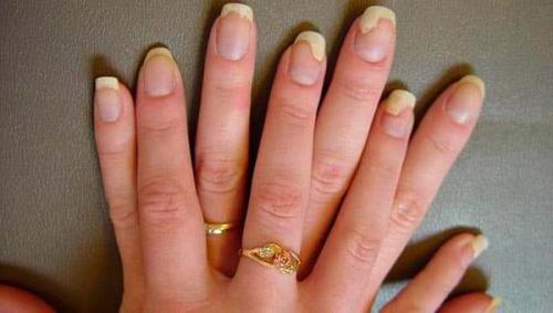 Нарощенные ногти, как долго держатся. Как долго можно ходить с нарощенными ногтями 08 Нарощенные ногти, как долго держатся. Как долго можно ходить с нарощенными ногтями 08