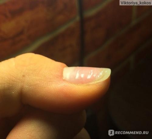 Выравнивание ногтевой пластины жидкой базой. Отличная база! Как я делаю выравнивание ногтевой пластины+фото