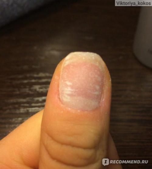 Выравнивание ногтевой пластины жидкой базой. Отличная база! Как я делаю выравнивание ногтевой пластины+фото