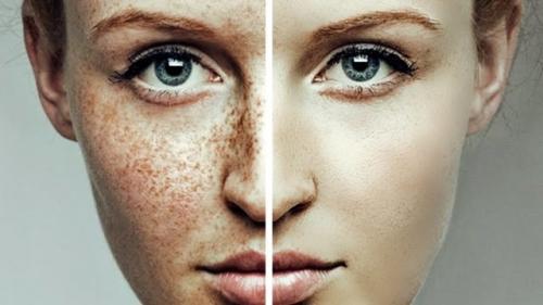 Отбеливающая маска для лица от пигментных пятен. Показания и противопоказания