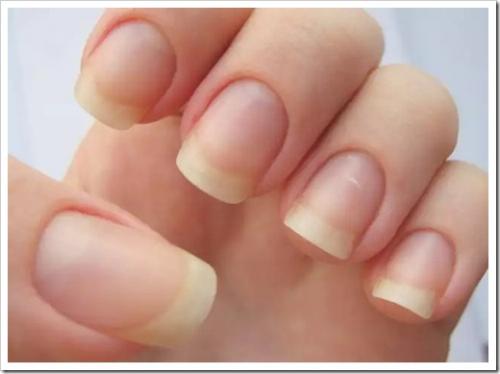 Как выровнять ногтевую пластину?
