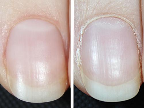 Как удалить кутикулу в домашних условиях без обрезания. Как удалить кутикулу без ножниц, щипчиков и ремувера