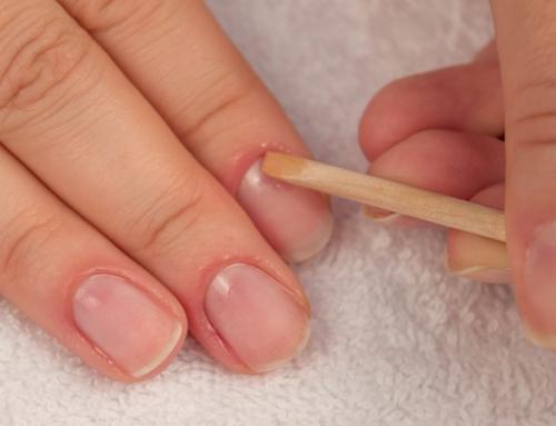 Очень сильно растет кутикула. Как сделать так, чтобы кутикула не росла?