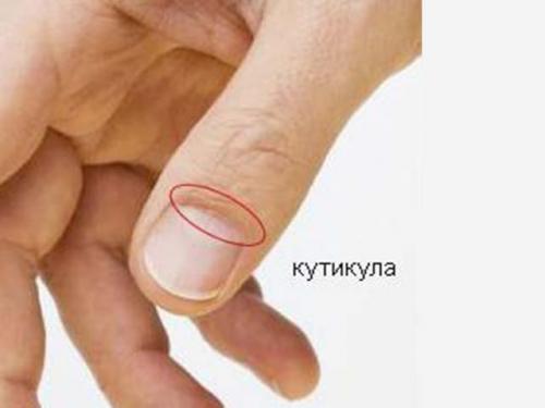 Удаление кутикулы содой. Что такое кутикулы