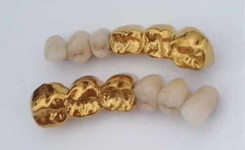 Медичне золото що це таке. Применение и свойства изделий из медицинского золота