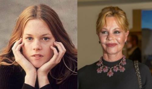 Актрисы которые плохо выглядят. Зарубежные