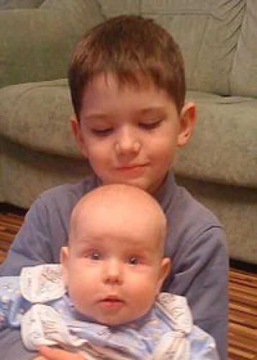 Комки Биша знаменитости. Уменьшили щечки: звезды, которые изменили контуры лица при помощи удаления комков Биша 01