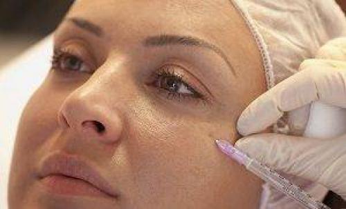 Как избавиться от кругов под глазами быстро. Как быстро избавиться от темных кругов под глазами за 2 дня 02 Как избавиться от кругов под глазами быстро. Как быстро избавиться от темных кругов под глазами за 2 дня 02