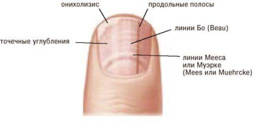 Что можно узнать о человеке по состоянию его ногтей