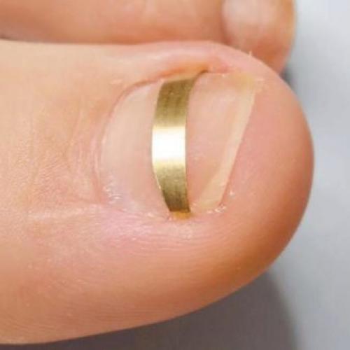 Как растут ногти на руках и за сколько времени. Строение ногтевой пластины 01 Как растут ногти на руках и за сколько времени. Строение ногтевой пластины 01