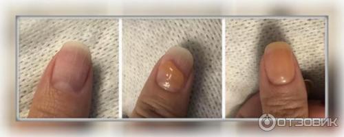 Сколько держится наращивание гелем. Сколько держатся ногти, нарощенные гелем 05 Сколько держится наращивание гелем. Сколько держатся ногти, нарощенные гелем 05