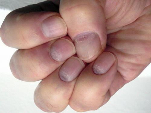 Ошибки мастеров маникюра. Так делать маникюр нельзя! 8 ошибок мастеров маникюра