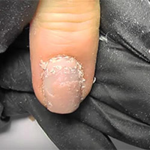 Можно ли гель лак снять жидкостью для снятия лака. Как снять лак-гель без специальной жидкости