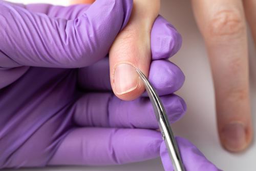 Как обрабатывать кожу вокруг ногтей. Такие разные: как правильно работать с разными типами кутикулы