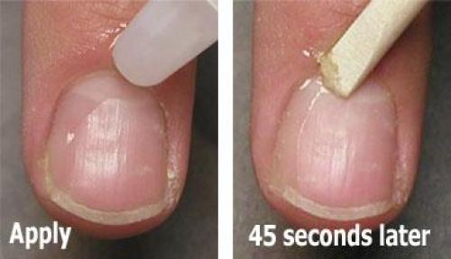 Как называется кожа вокруг ногтя. Ухаживаем за кутикулой в домашних условиях правильно — инструменты для удаления