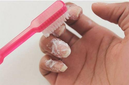 Как обрабатывать кожу вокруг ногтей. Как нехитрым способом избавиться от кутикулы практически навсегда