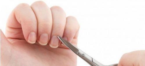 Как обрабатывать кожу вокруг ногтей. Как нехитрым способом избавиться от кутикулы практически навсегда