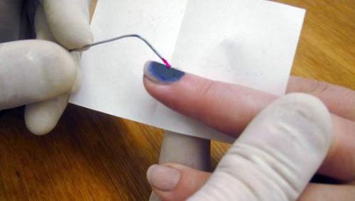 Темная кожа вокруг ногтей. Как лечить черные ногти