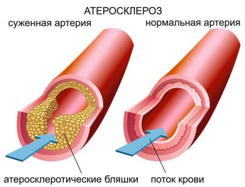 Красные полоски под ногтями. Виды заболеваний, при которых появляются полосы на ногтях рук
