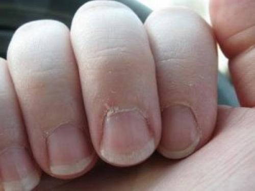 Как обрабатывать кожу вокруг ногтей. Как правильно ухаживать за кутикулой и забыть о заусенцах?