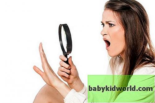 Ногти на руках стали волнистыми и бугристыми. Что представляют собой волнистые ногти, их виды 02 Ногти на руках стали волнистыми и бугристыми. Что представляют собой волнистые ногти, их виды 02