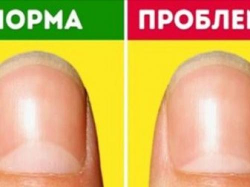 Сколько растет ноготь. Как происходит процесс роста ногтей 05