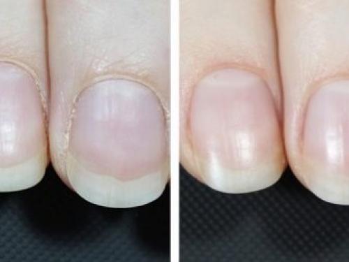 Сколько растет ноготь. Как происходит процесс роста ногтей 03