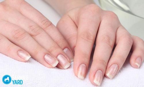 Сухая кожа вокруг ногтей. Причины пересыхания кожи у ногтей