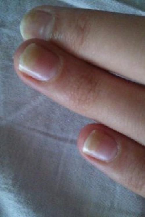 Что делать, чтобы гель-лак не отслаивался. Почему отслаивается гель-лак от ногтей: причины и особенности