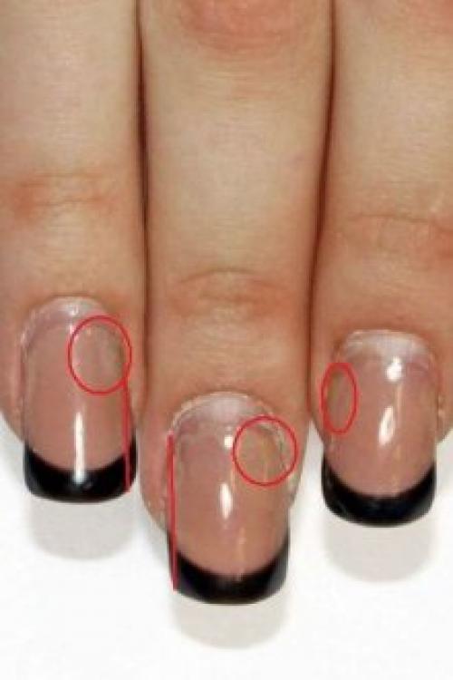 Отслаивается гель-лак у кутикулы. Почему отслаивается гель-лак от ногтей: причины и особенности