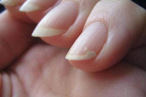 Отслаивается гель-лак у кутикулы. Почему отслаивается гель-лак от ногтей: причины и особенности 12