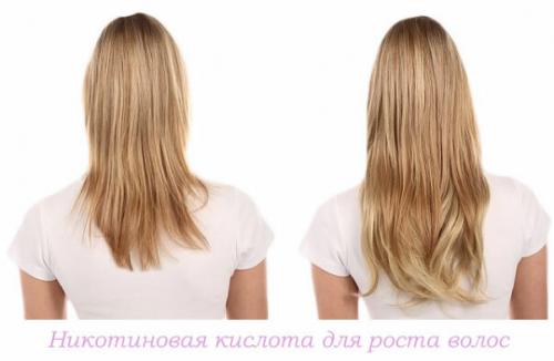 Отращиваю волосы. Хитрость №1: Изучаем подшерсток