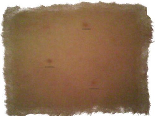 Родинки в виде треугольника на лице. Фигуры из родинок в виде треугольника