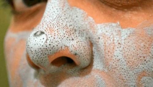 Маска для лица из алоэ от морщин в домашних условиях. Самые лучшие маски 12 Маска для лица из алоэ от морщин в домашних условиях. Самые лучшие маски 12