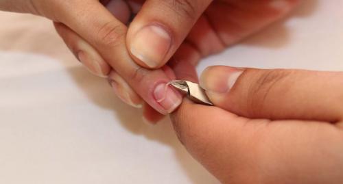 Как определить, что кутикула начала сохнуть. Почему сохнет кутикула: причины появления, как определить и исправить проблему (полезные советы)