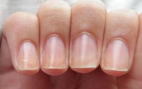 Как избавиться от сухих ногтей и кутикулы 03 Как избавиться от сухих ногтей и кутикулы 03