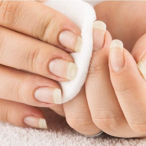 Почему гель-лак отходит от ногтя возле кутикулы. Причина первая: ногти не готовы