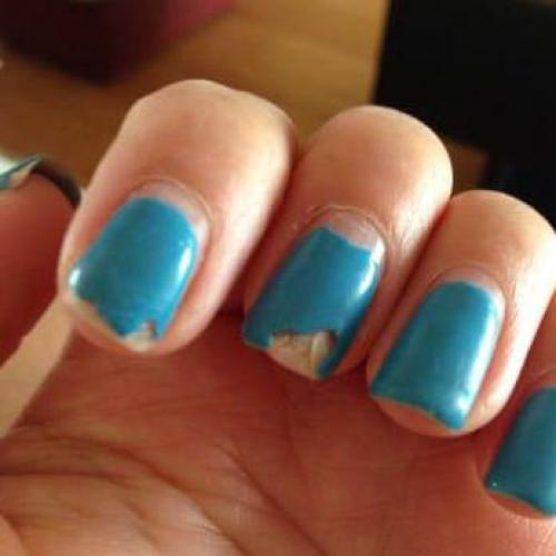 Почему не держится гель-лак на ногтях. Причины отхождения лака, связанные с особенностями организма 08