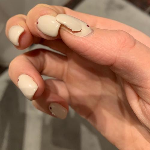 Причины отслойки гель-лака не зависящие от мастера. Основные причины появления отслоек покрытия