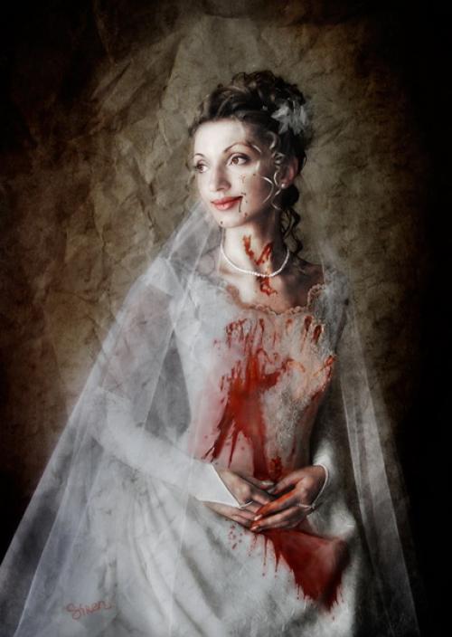 УЗИ при младенческой гемангиоме околоушной железы. УЗИ при венозной мальформации околоушной железы 10