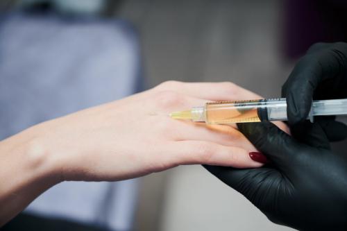 Уход за руками: как справиться с проблемами кожи 02 Уход за руками: как справиться с проблемами кожи 02