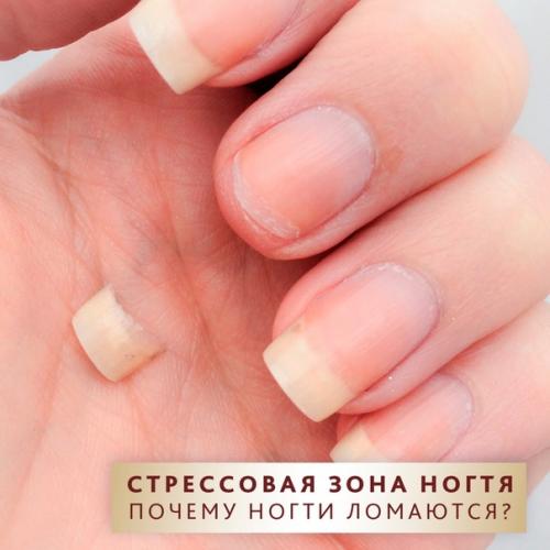 Не держаться нарощенные ногти. Что делать, чтобы нарощенные ногти долго держались 01