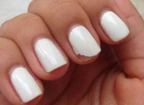 Почему отваливаются ногти гель-лак. Болезни и индивидуальные особенности ногтевой пластины