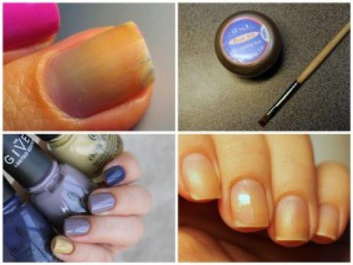 Почему нарощенные ногти трескаются по бокам. Эксплуатация