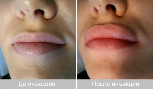 Скульптурные приемы для лица: как достичь идеальной формы 23 Скульптурные приемы для лица: как достичь идеальной формы 23