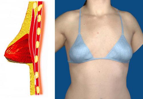 Как часто встречаются уши спаниеля у женщин. Все формы и типы женской груди в одной статье