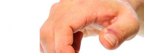 Воспаление кожи вокруг ногтя на руке. Цены на услуги 02