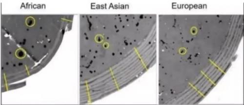Как избежать проблем с кудрявыми волосами. 5 причин, по которым кудрявые волосы сухие и ломкие, и что с этим делать