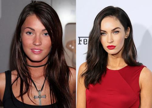 Деми Мур и другие звезды, чью жизнь изменила пластическая хирургия